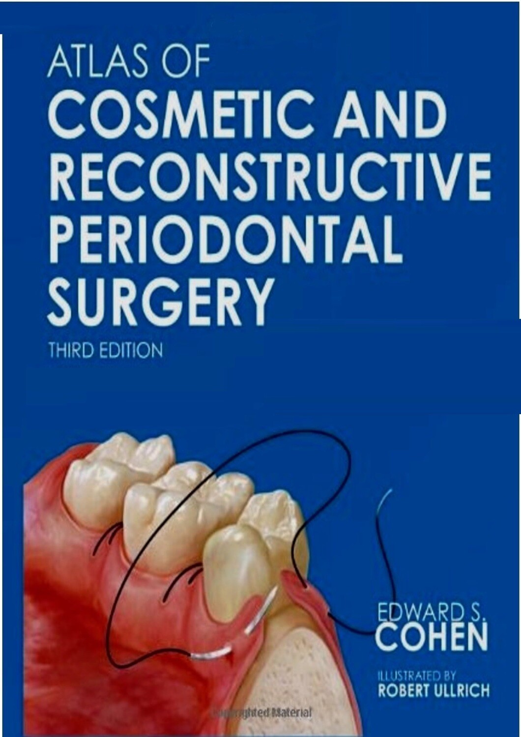 Atlas of Cosmetic and Reconstructive Periodontal Surgery