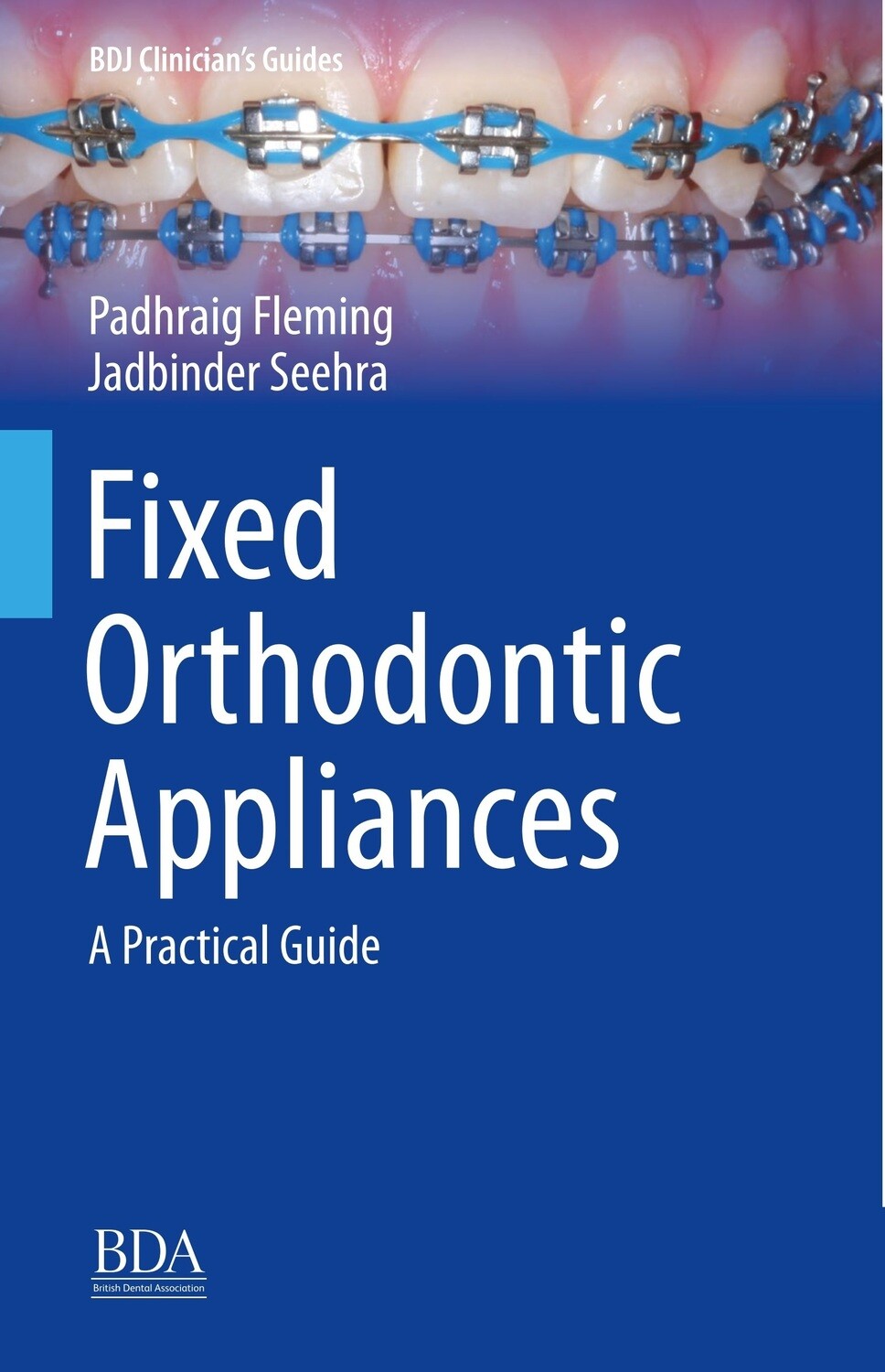 Fixed Orthodontic Appliances A Practical Guide