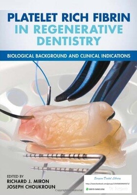 Platelet Rich Fibrin in Regenerative Dentistry