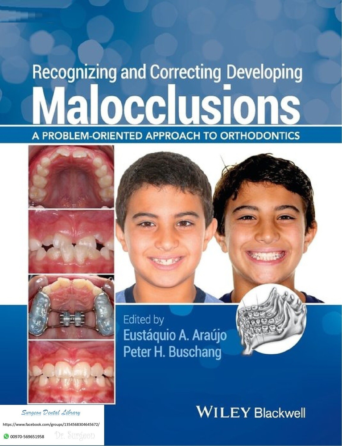 Recognizing and correcting developing malocclusion