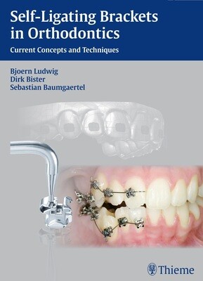 Self-ligating brackets in orthodontics