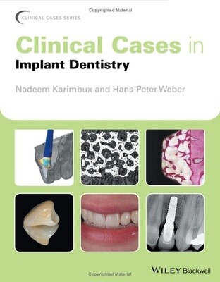 Clinical Cases in Implant Dentistry