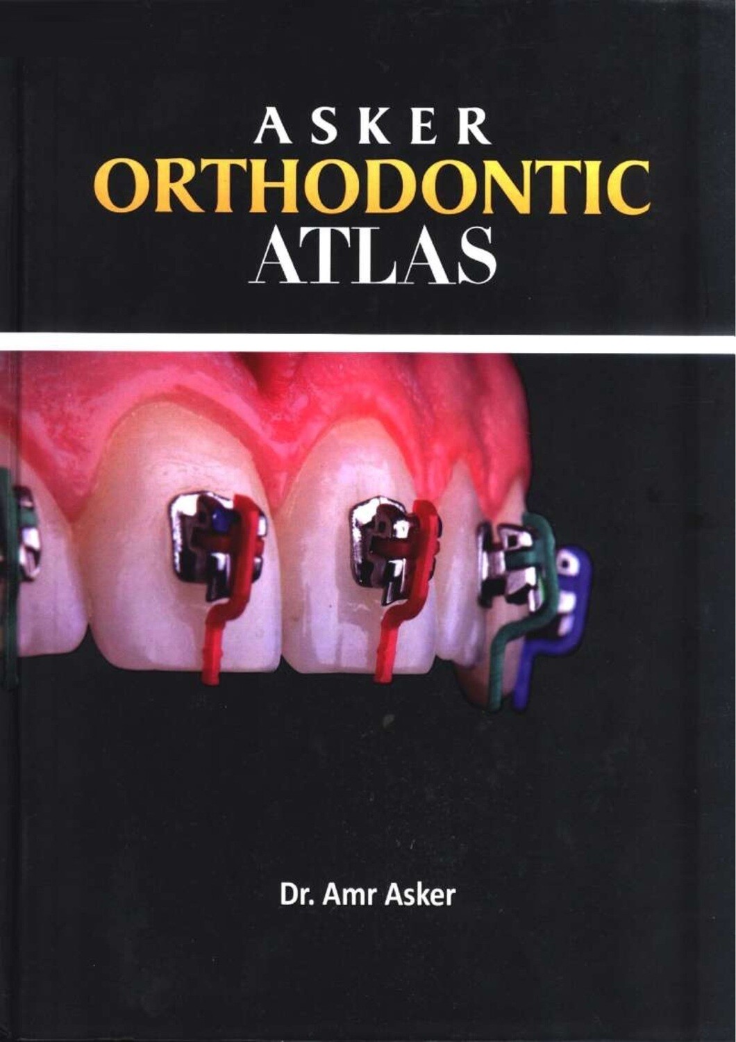 Asker orthodontic atlas