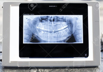 X-ray Viewer