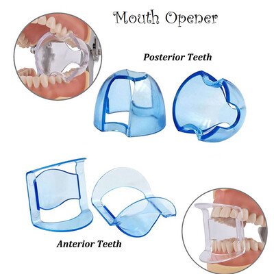 Mouth Opener