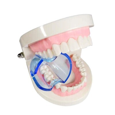 Mouth Opener