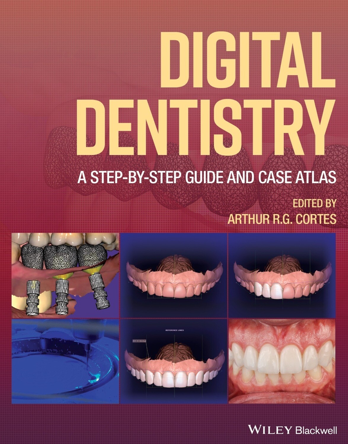 Digital Dentistry: A Step-by-Step Guide and Case Atlas