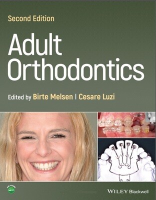 Adult Orthodontics