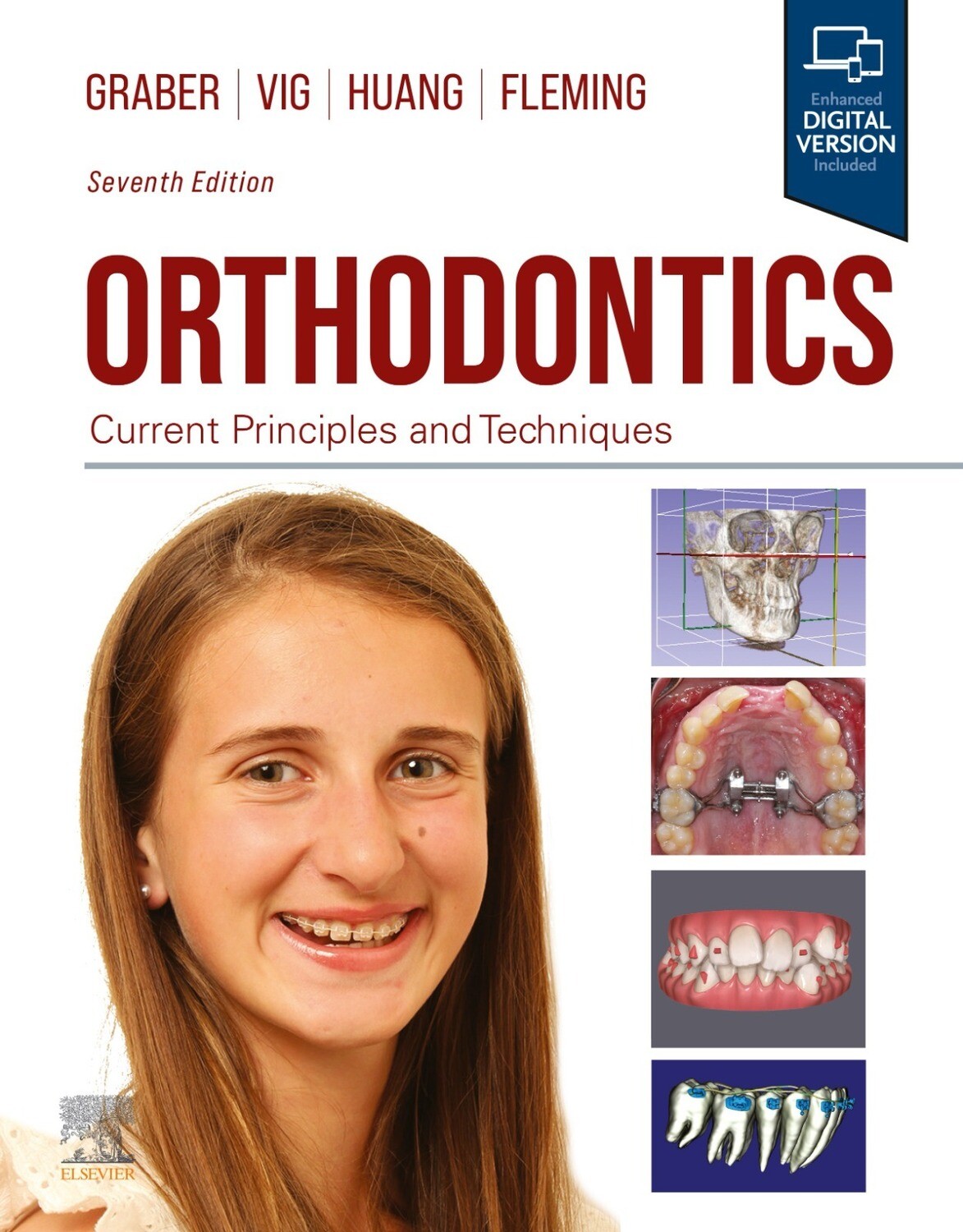 Orthodontics current principles and techniques