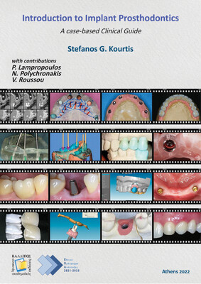 Introduction to Implant Prosthodontics