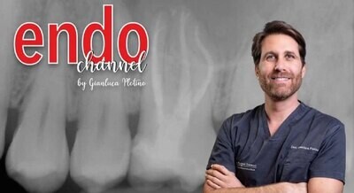 The excellence in endodontic treatment made easy by Gianluca Plotino