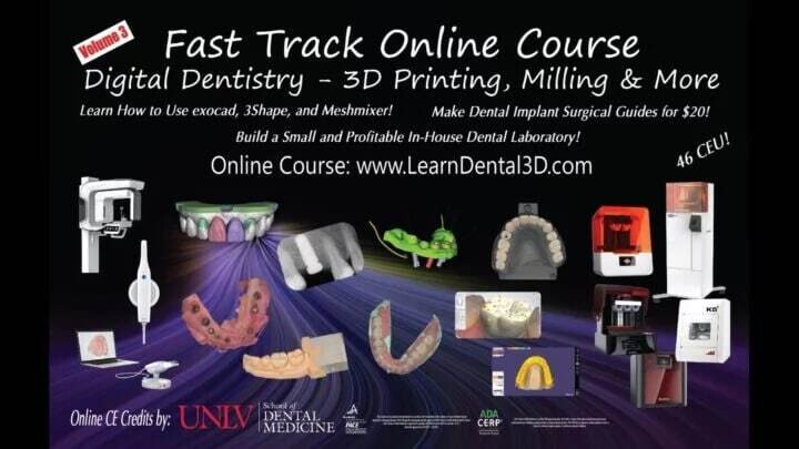 Digital Dentistry – Intraoral Scanning, Software, 3D Printing, and Milling