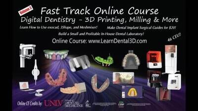 Digital Dentistry – Intraoral Scanning, Software, 3D Printing, and Milling