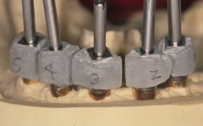 A-Z in Restorative Implant Dentistry