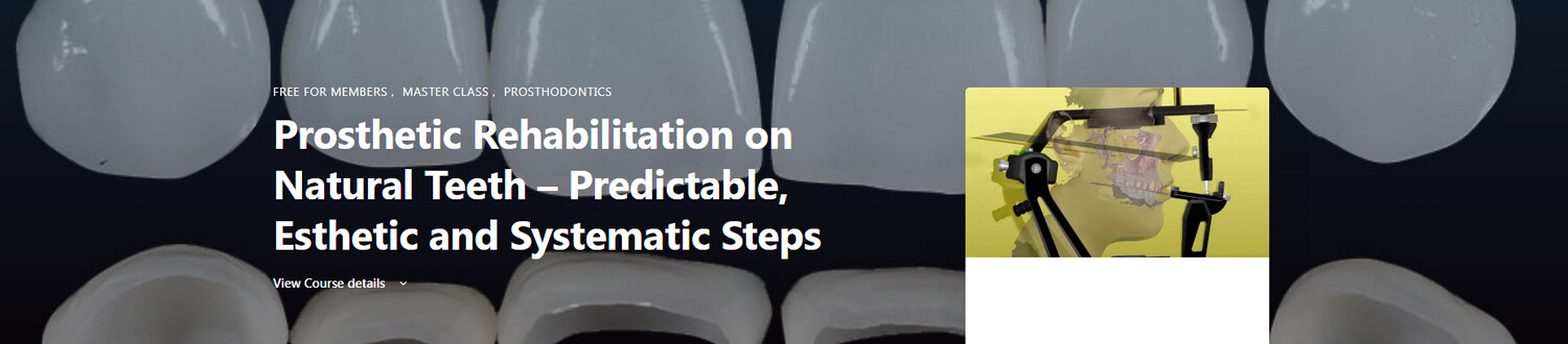 Dental Prosthetic Rehabilitation on Natural Teeth