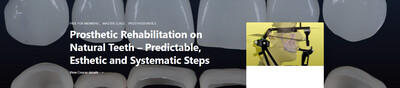 Dental Prosthetic Rehabilitation on Natural Teeth