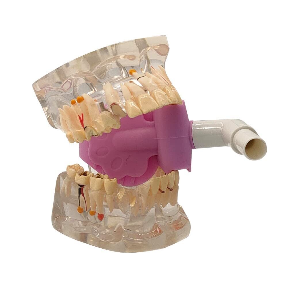 Bite block with Saliva Shield