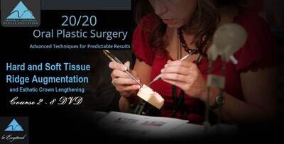 Hard and Soft Tissue Ridge Augmentation and Esthetic Crown Lengthening