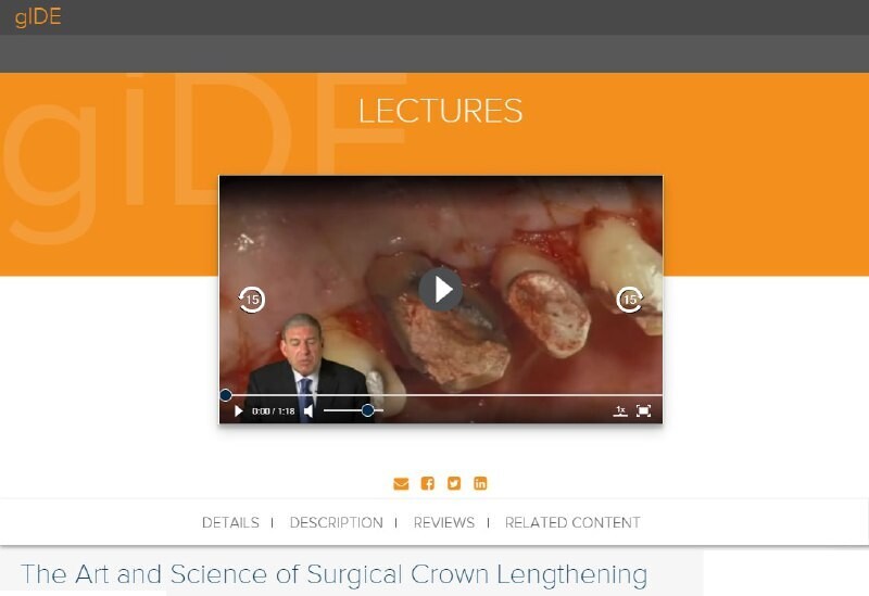 The Art and Science of Surgical Crown Lengthening