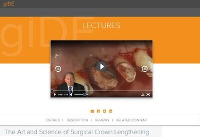 The Art and Science of Surgical Crown Lengthening