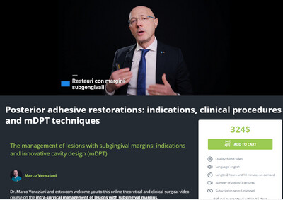 Posterior Adhesive Restorations