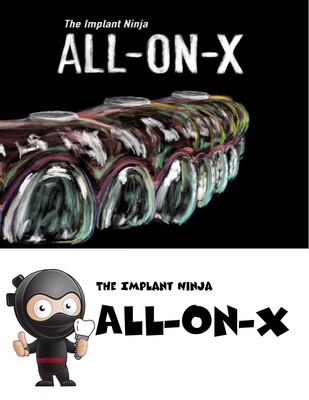 Implant Ninja The All on X