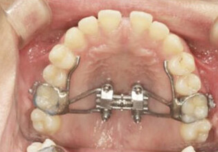Orthodontic Courses