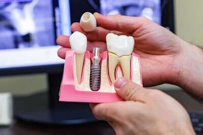 Implant Courses