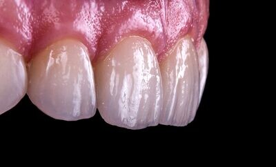 Esthetic Dentistry Courses