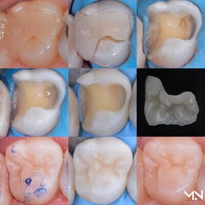 Restorative dentistry Courses