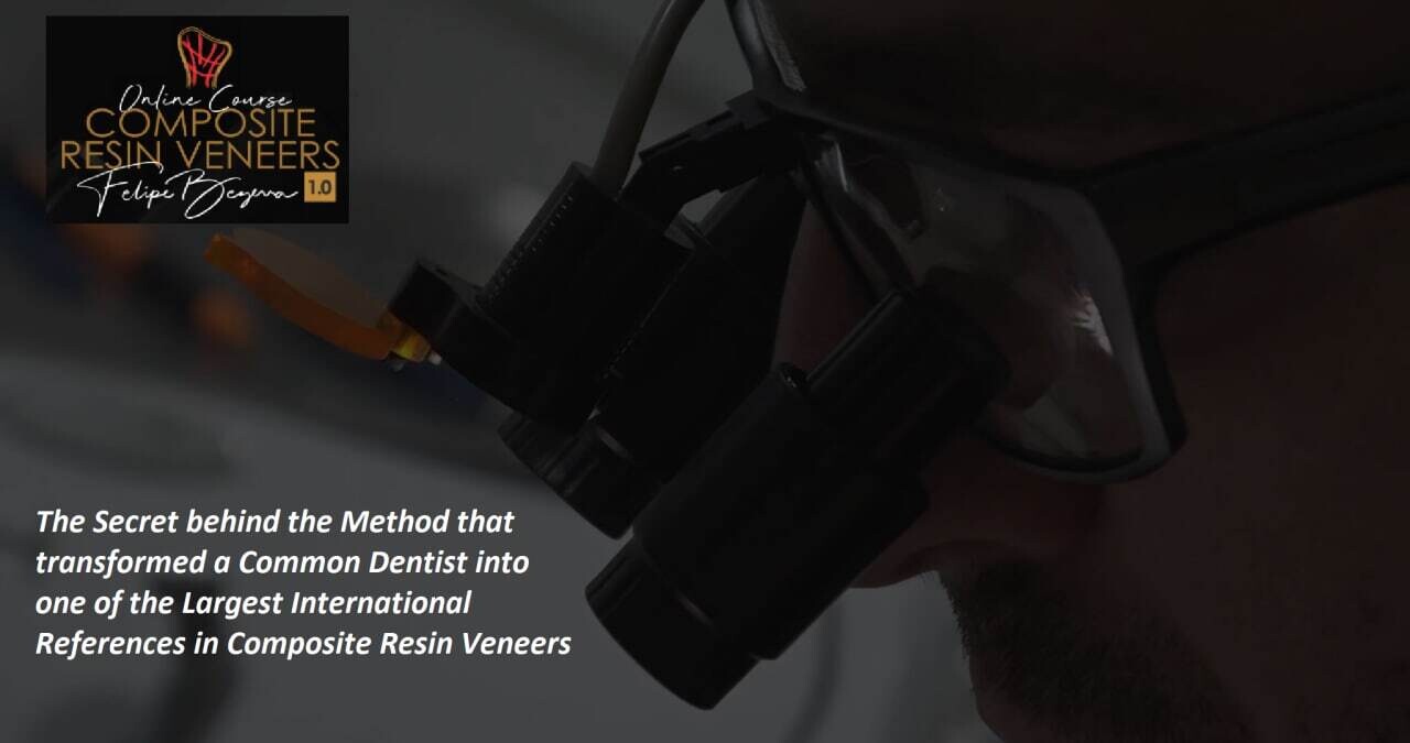 Composite resin Veneers