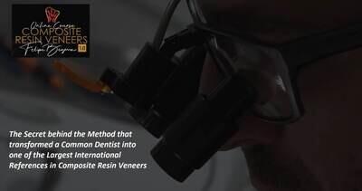 Composite resin Veneers