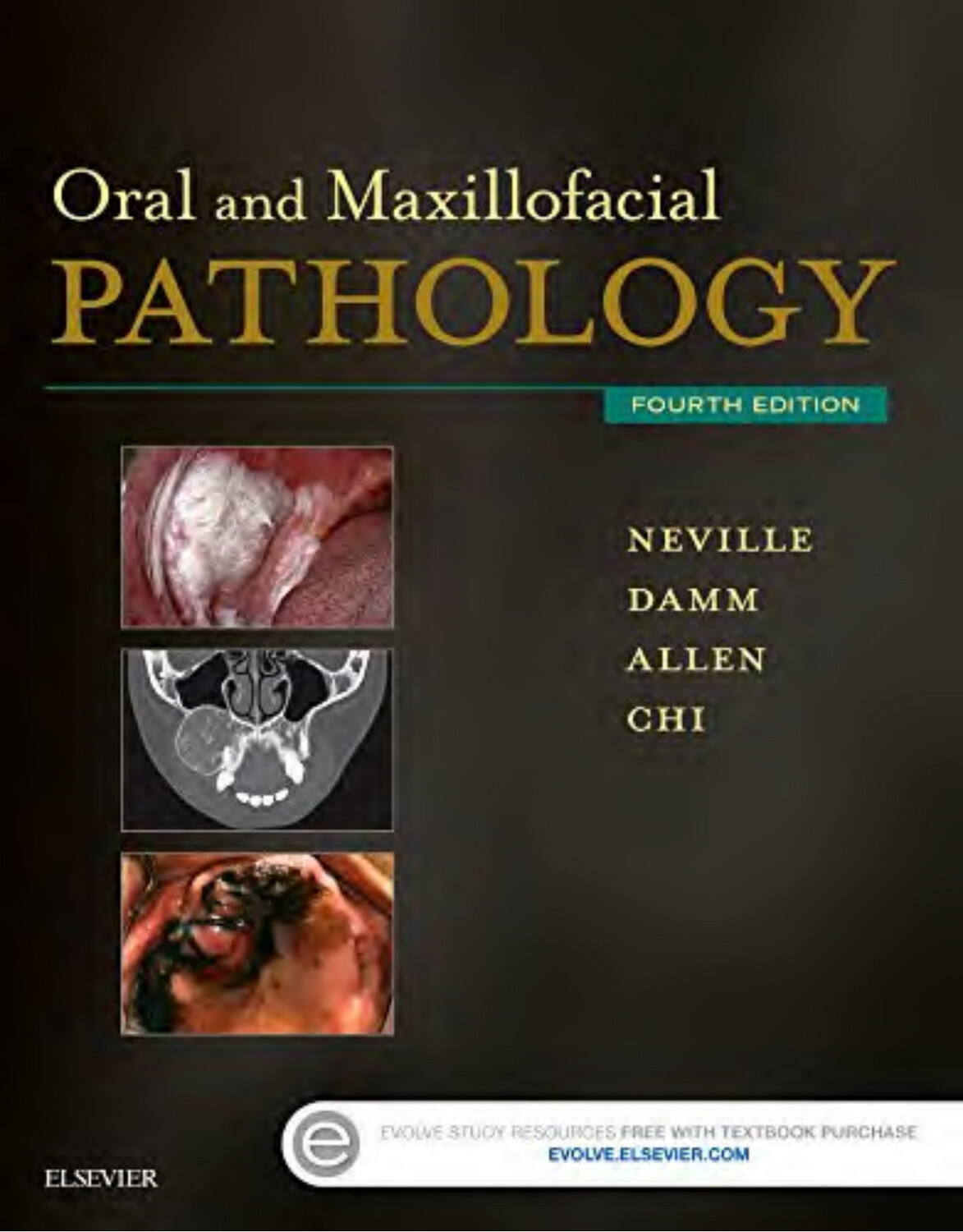 Oral and Maxillofcial Pathology