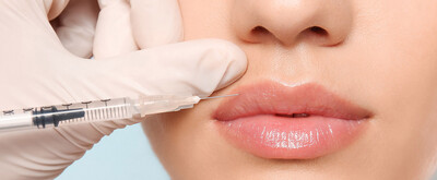 Facial Esthetic