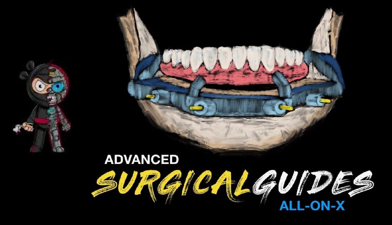 Implant Ninja, Advanced Surgical Guides - All on X