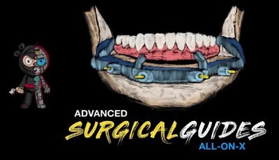 Implant Ninja, Advanced Surgical Guides - All on X