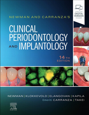 Carranza&#39;s Clinical Periodontology