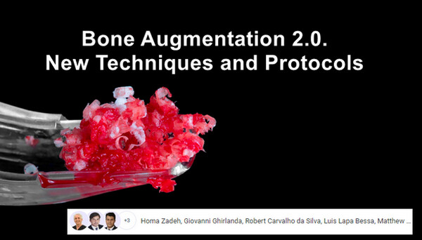 Bone Augmentation 2.0, New Techniques and Protocols