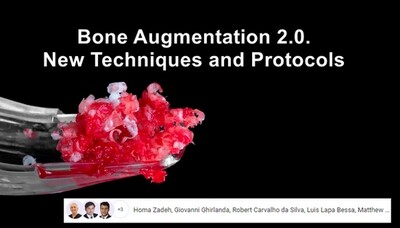 Bone Augmentation 2.0, New Techniques and Protocols
