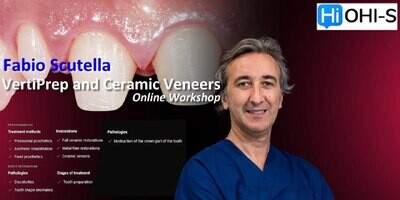 Vertiprep and Ceramic Veneers, Online Workshop - Fabio Scutella