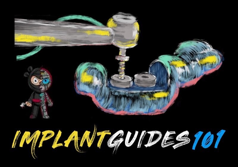 Implant Ninja, Implant Guides 101