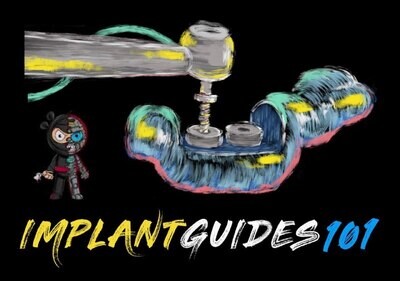 Implant Ninja, Implant Guides 101
