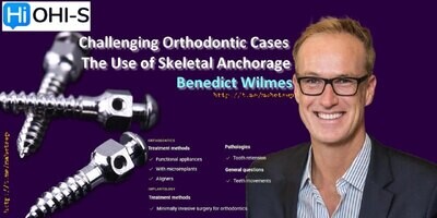 Challenging Orthodontic Cases, The Use of Skeletal Anchorage