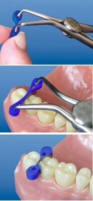 Elastic Fixing Wedge
