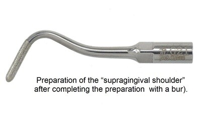 Preparation Scaler Tips
