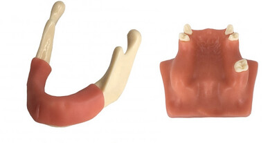 Implant Training Model