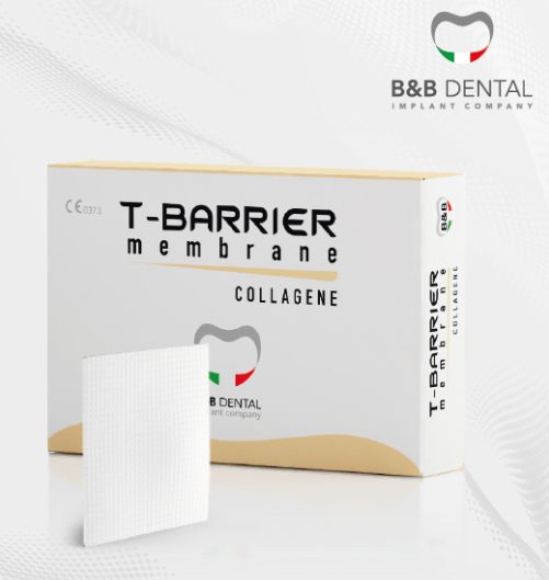 T-Barrier Collagen Membrane