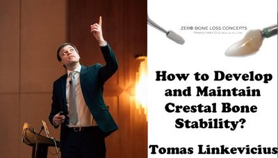 Zero Bone Loss Concepts
