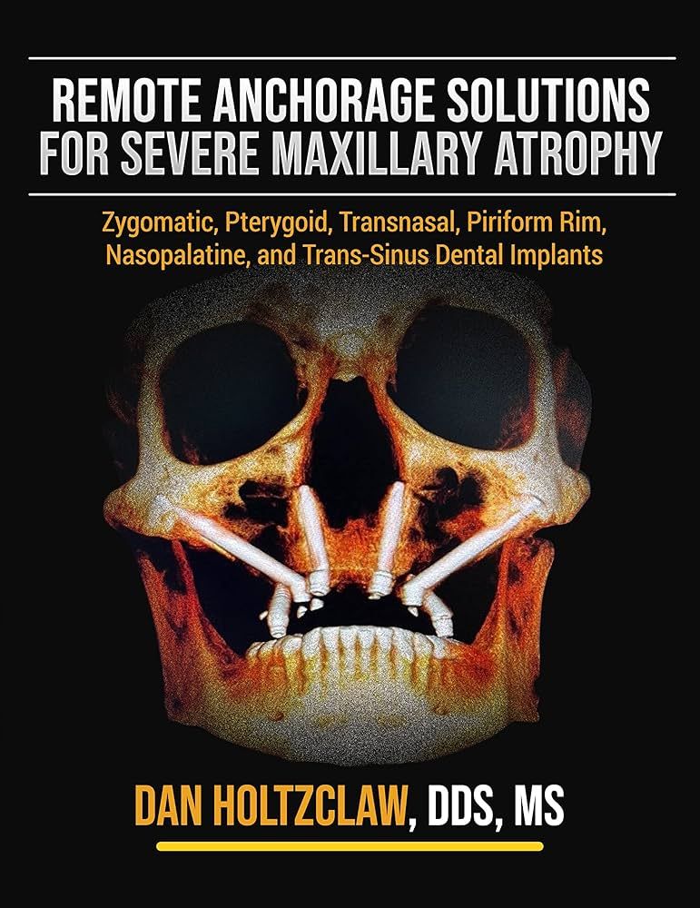 Remote Anchorage Solutions for Severe Maxillary Atrophy