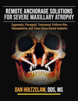 Remote Anchorage Solutions for Severe Maxillary Atrophy